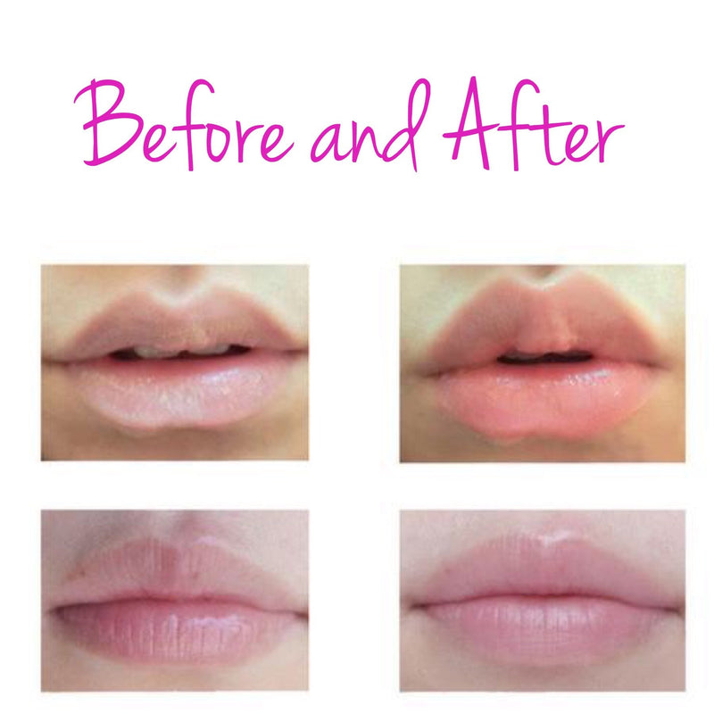 collagen-lip-mask-before-and-after